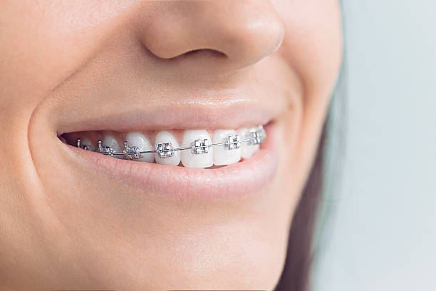 Best Periodontal (Gum) Disease Treatment  in Solana Beach, CA